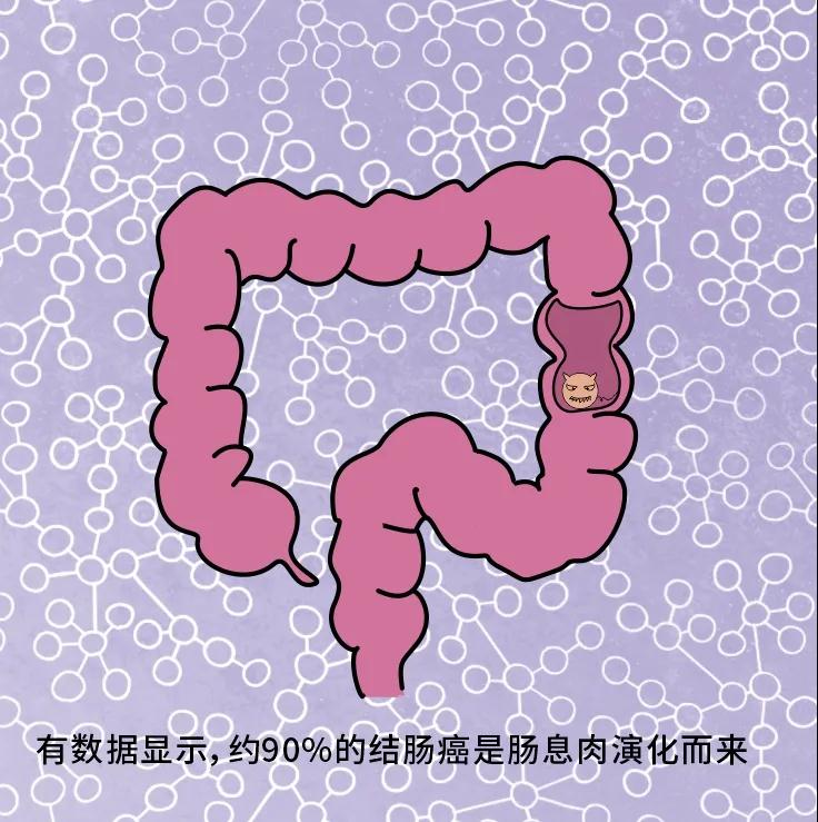 奪走“黑豹”生命的結(jié)腸癌，到底什么來頭？