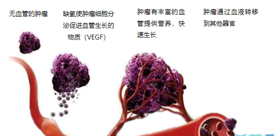 晚期腫瘤為什么會復發(fā)轉(zhuǎn)移？