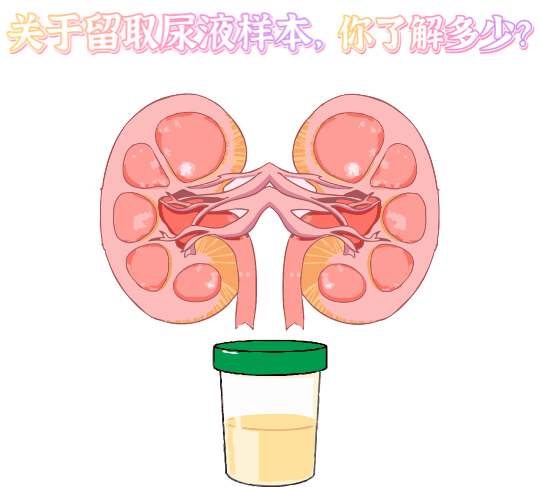 做尿檢，不得不說的注意事項！