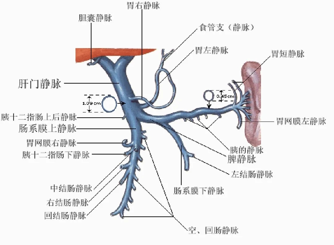 反復(fù)嘔血、黑便怎么辦？TIPS手術(shù)能解決