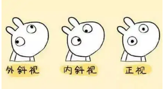 小baby老歪著頭？警惕斜頸! 這樣糾正……