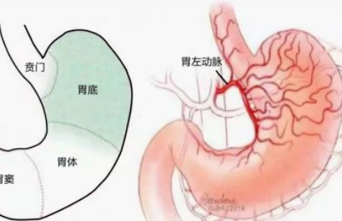 不開(kāi)刀不吃藥不餓肚子，微創(chuàng)介入減肥靠譜嗎？