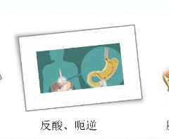 關(guān)愛身體健康，輕松檢查胃腸