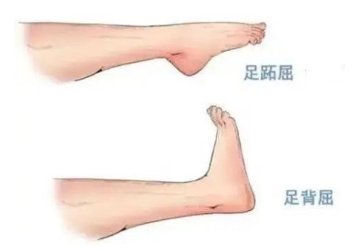 扭胯小連步、動感搖花手……“科目三”雖火，運動損傷也要防！