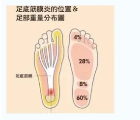每年新生數(shù)百萬(wàn)足底筋膜炎患者！國(guó)際醫(yī)學(xué)專家提醒：跑步要選擇合適的鞋